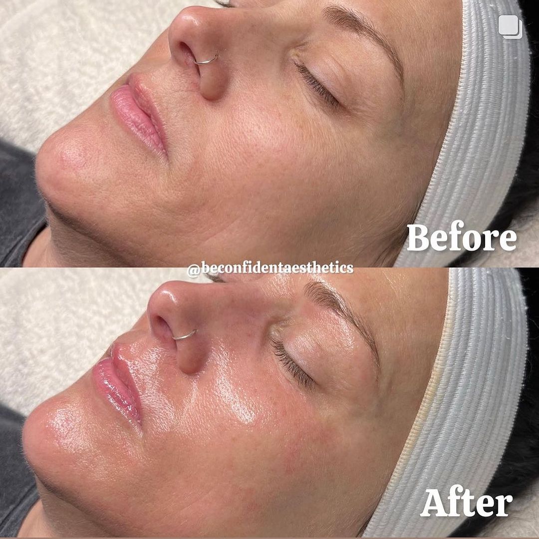 Krx VTox Lift Mask