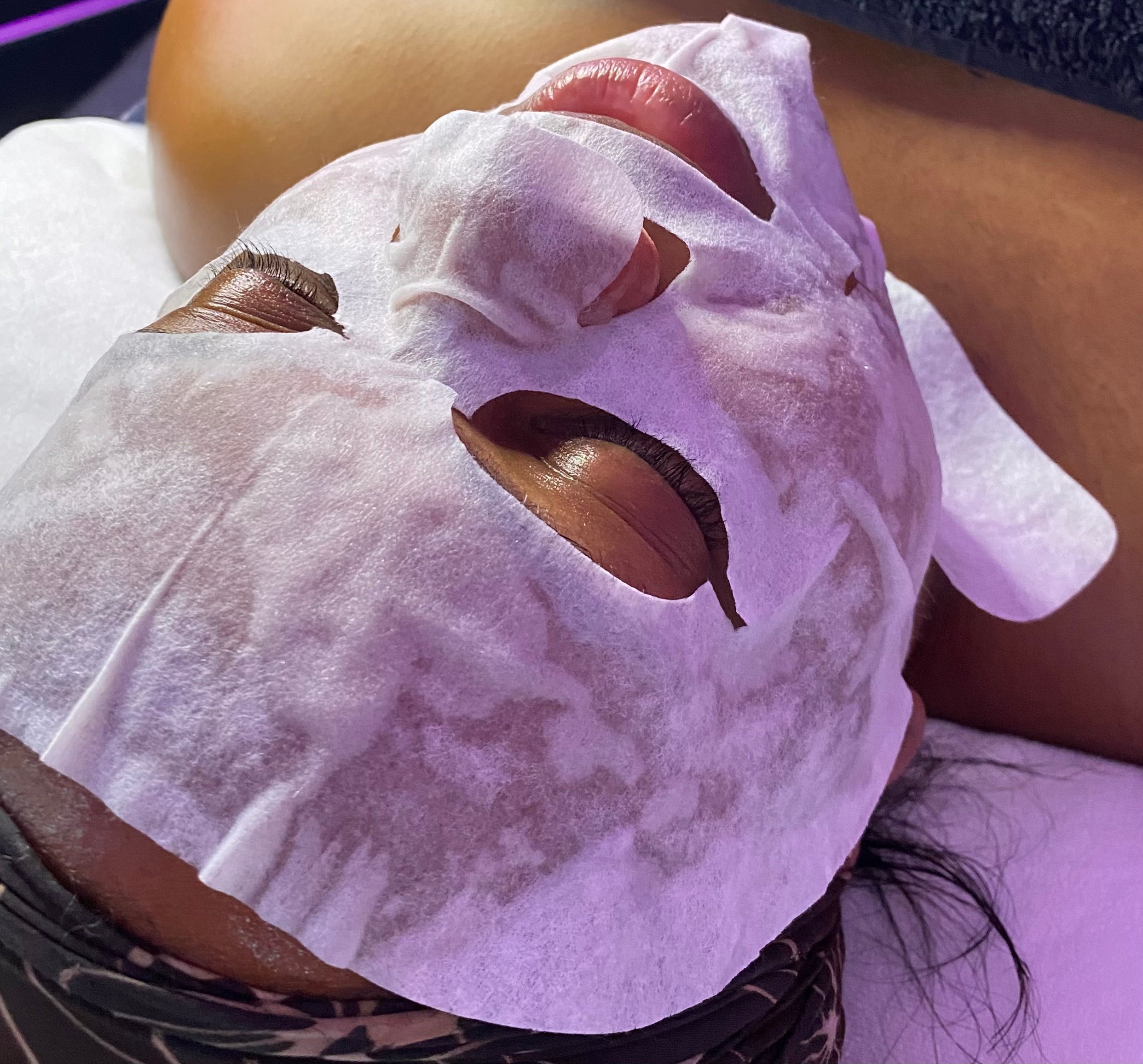 Krx C02 Carboxy Therapy – Kria | Professional Korean Skincare